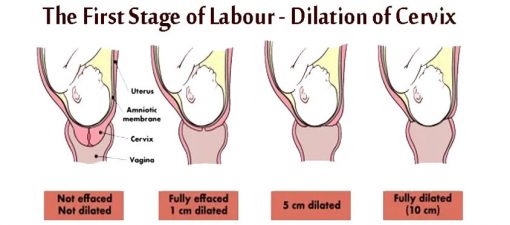 vaginal examination