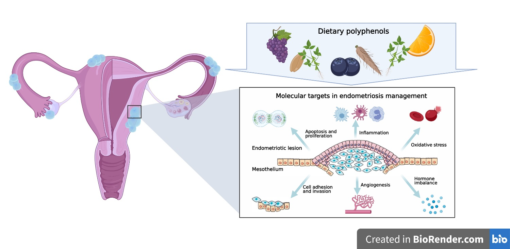 polifenol membantu masalah endometriosis nutrisi untuk endometriosis