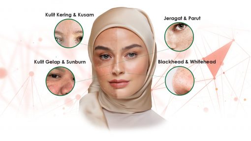 masalah pada muka