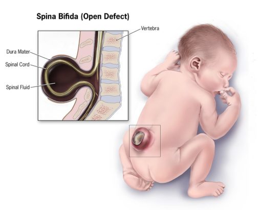 asid folic untuk ibu mengandung kenapa perlu folic acid