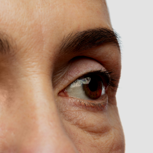 cara hilangkan eyebag