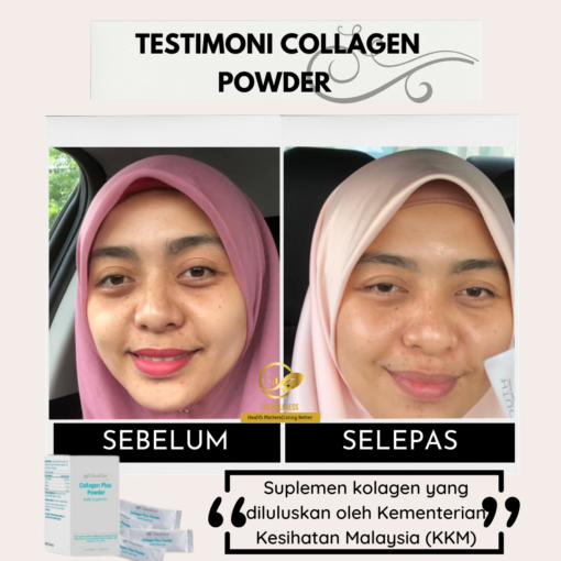 testimoni collagen shaklee