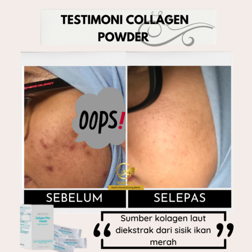 testimoni collagen shaklee