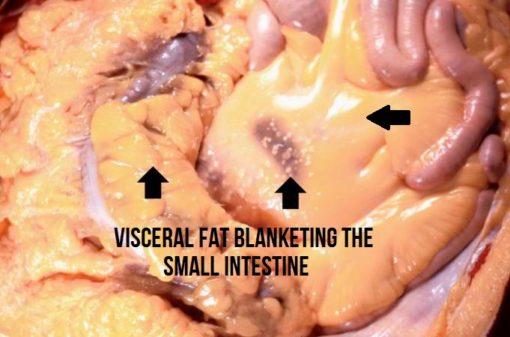 bahaya visceral fat