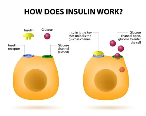cara ubah insulin resistance