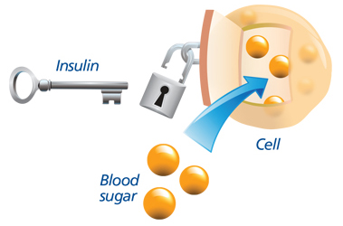insulin resistance