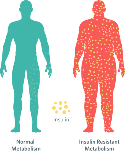 reverse insulin resistance insulin resistance