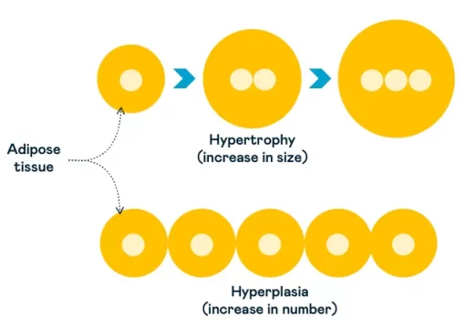 insulin resistance