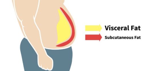 visceral fat buncit