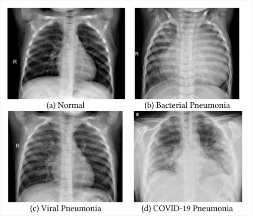 vaksin kerajaan pneumococcal vaccine