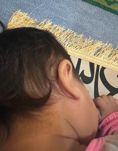 eczema anak eczema belakang telinga