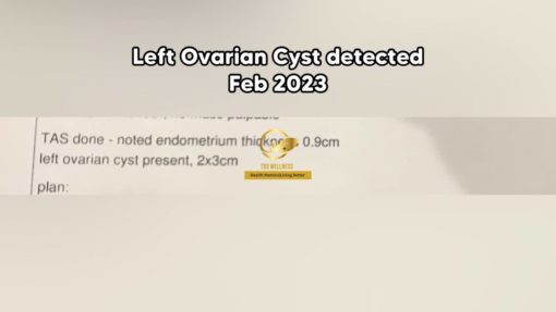 cara kecutkan cyst