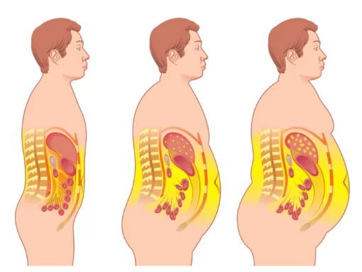 danger visceral fat 
