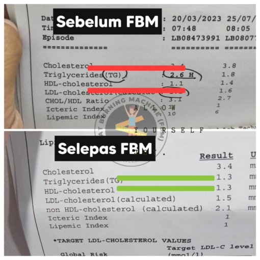 Keradangan triglyceride kurang