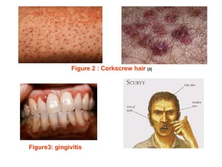 kenapa penting vitamin c