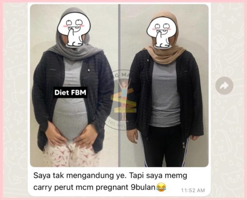 hilangkan perut buncit