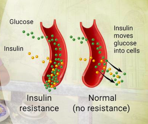 insulin resistance punca gemuk