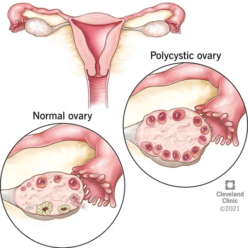 diet untuk wanita
