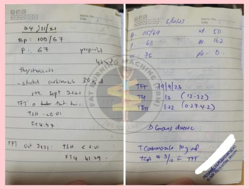 hormon tiroid terlebih hormon tiroid terlebih