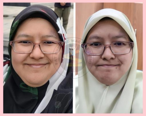 diet pcos turun berat