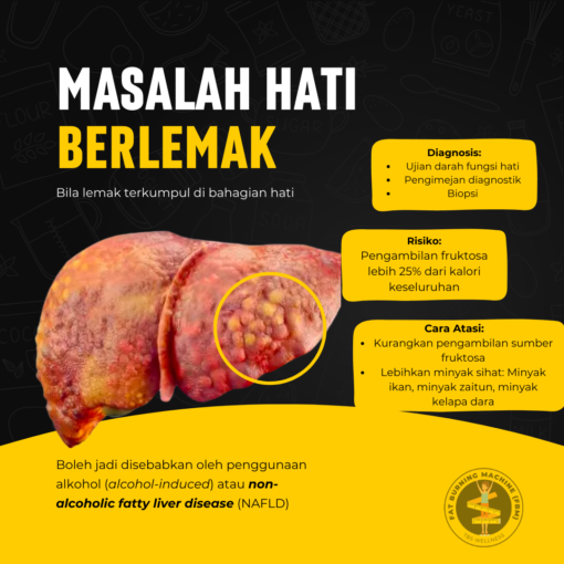 cara rawat hati berlemak