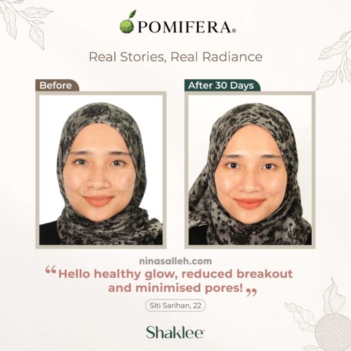 skincare shaklee lulus kkm cara hilangkan radang kulit