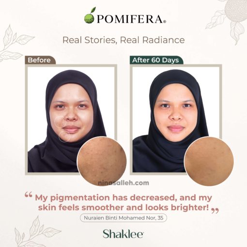 cara dapat tona kulit sekata testimoni pomifera shaklee