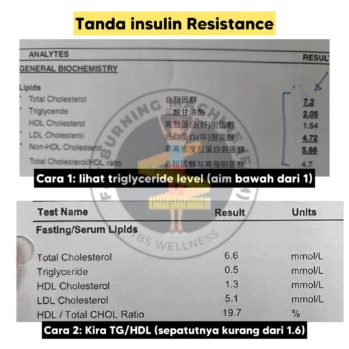 bacaan kolesterol normal tanda insulin resistance