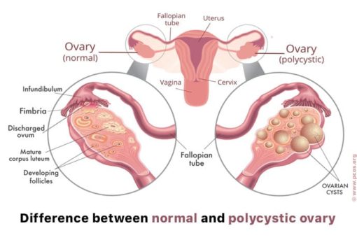 cara stabilkan hormon wanita