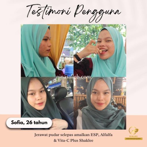  cara hilangkan jerawat