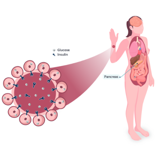 tanda insulin resistance