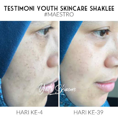 cara guna toner youth