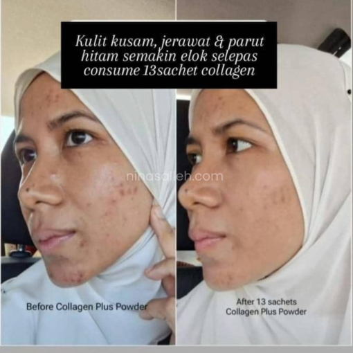 shaklee collagen plus powder review collagen pudarkan jerawat