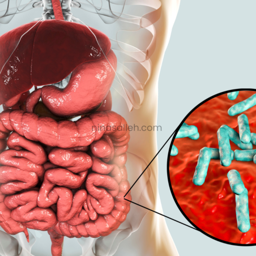 cara pulihkan gerd kepentingan probiotic