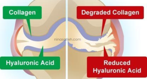 collagen shaklee untuk sakit sendi kolagen untuk sakit sendi