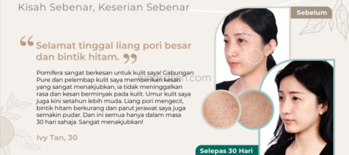 cara elakkan kulit kering