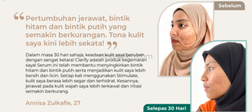 cara jaga muka kulit kering