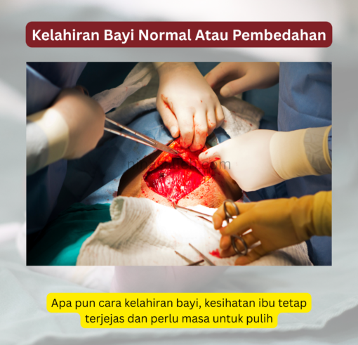 luka bersalin lambat sembub cepatkan luka bersalin