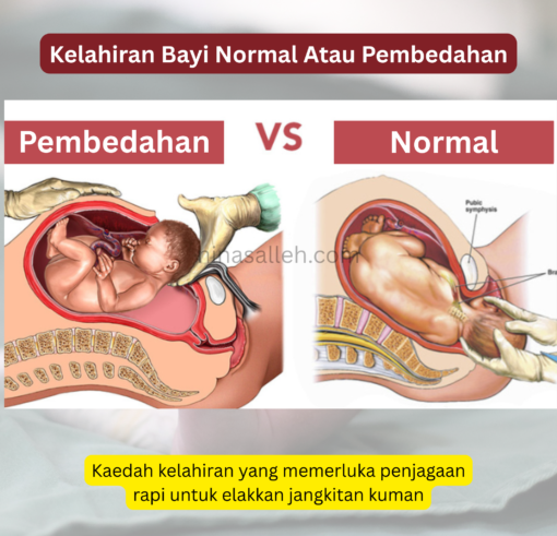 luka bersalin sembuh cara sembuhkan luka bersalin