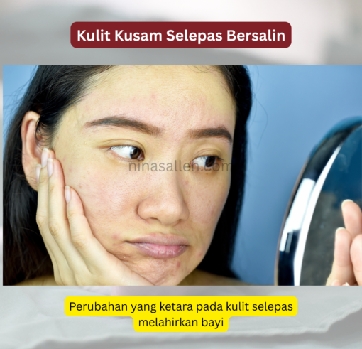 kulit kusam selepas bersalin cara rawat kulit kusam