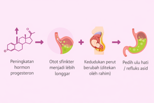 elakkan gerd mengandung punca gerd semasa mengandung
