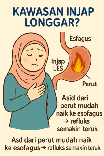 cara elak angin mengandung elak gerd waktu mengandung